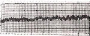 geomagnetic waves from the earths crust incorporated in AMS magnetic field therapy