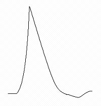 pulse shape magnetic field therapy by AMS device